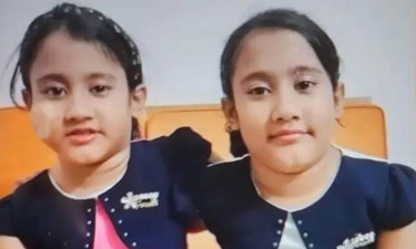 সিসিইউতে যন্ত্রণায় কাতরাচ্ছে যমজ বোন সারিনা-সাইবা