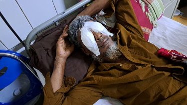 জমি নিয়ে বিরোধ: বাবার সামনে এক ভাইয়ের চোখ তুলে নিলো অন্য ২ ভাই