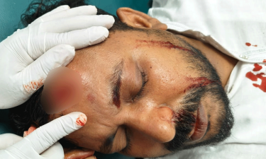 বোতল ছুড়ে শিক্ষকের মাথা ফাটাল শিক্ষার্থী
