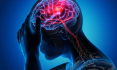 প্রেশার বাড়লে যে কোনো সময় স্ট্রোকের ঝুঁকি! কীভাবে এড়াবেন বিপদ?