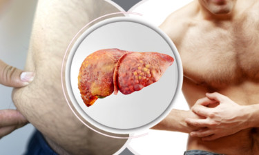 ফ্যাটি লিভারের সমস্যা? এই ৭ খাবারই হতে পারে সমাধান