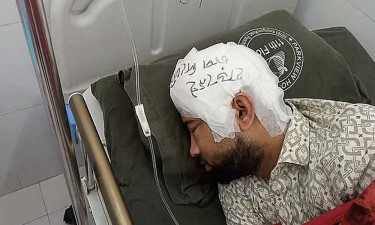 ফ্রিজে রাখা খুলি ২ মাস পর লাগানো হলো মামুনের মাথায়