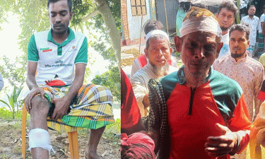 আড়াইহাজারে আওয়ামী লীগ–বিএনপির সংঘর্ষে ককটেল বিস্ফোরণ, নারীসহ আহত ১০